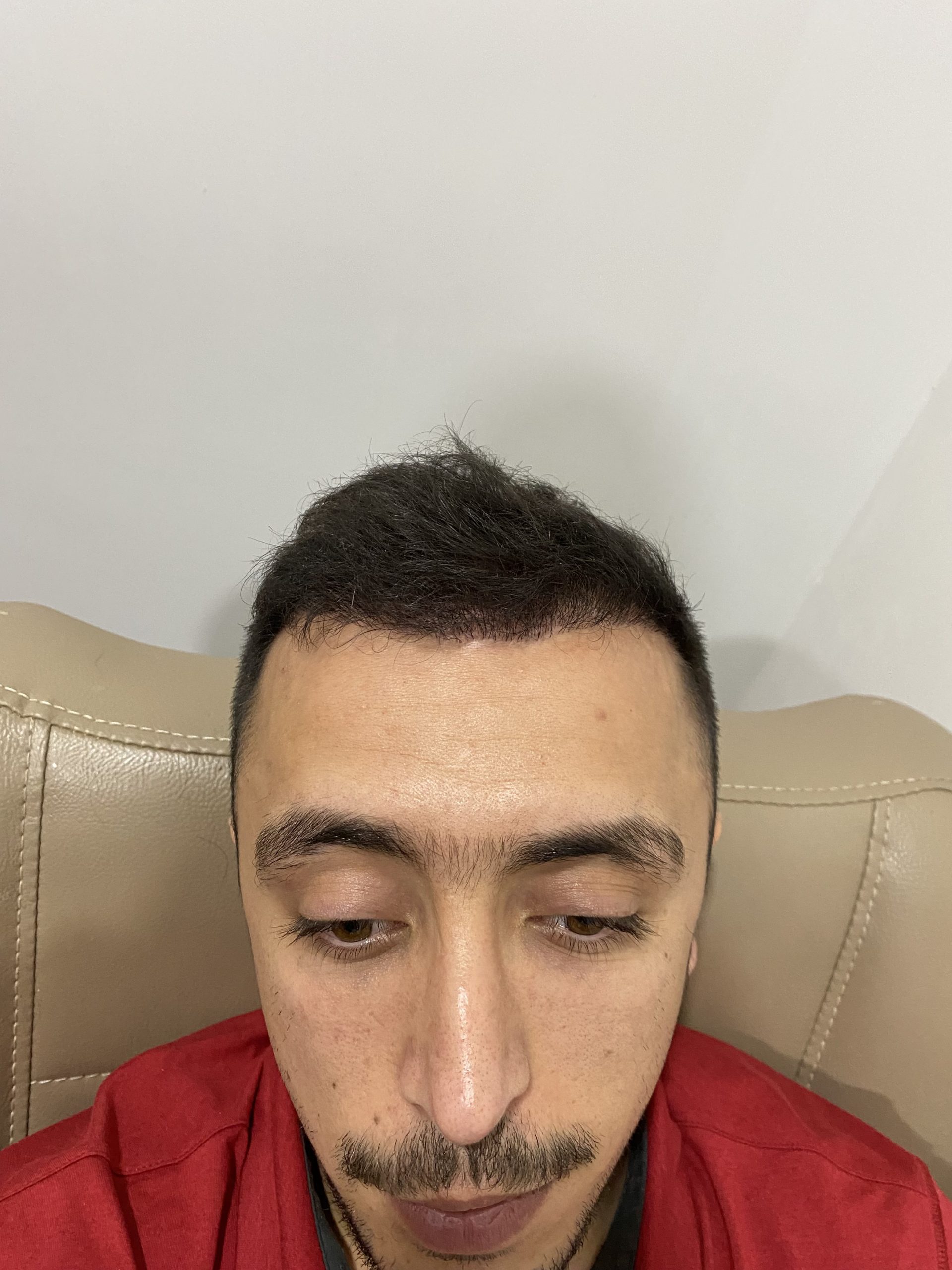 5 (2)